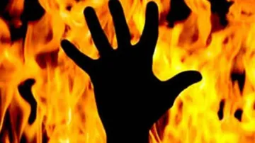 Woman Sets Herself On Fire; Husband, Mother-In-Law Suffer Burn Injuries Trying To Save Her