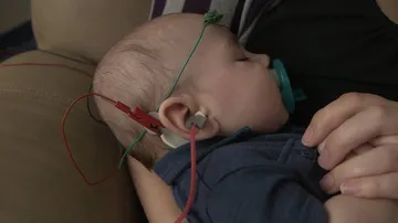 Infants with heart operation risk deafness