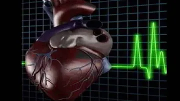 IIT Roorkee students develop 'Dhadkan' app for heart patients