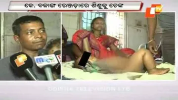 8-month-old branded with hot iron; hospitalised