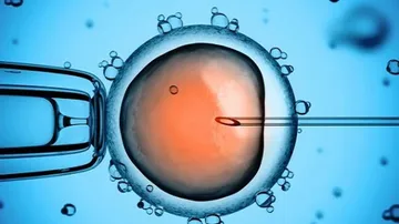 One million babies born in US using IVF: Report