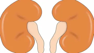 Kidney swap unites Hindu, Muslim families