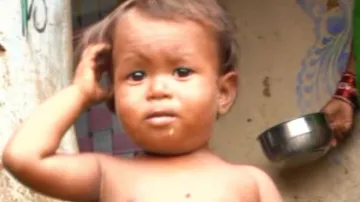 After sattu scam, extensive malnutrition reported in Bolangir