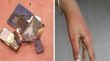 Odisha Girl's Mobile Phone Explodes During Online Study