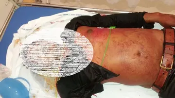 Youth shot dead in Capital
