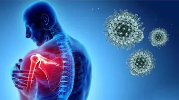 Neurological Disorder Among COVID Symptoms: Case Presentation