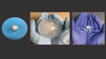 New ingestible, expanding pill to track ulcers, stomach cancer