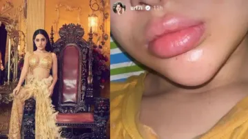 Unwell Urfi Javed shares selfie of swollen lips; unsure if it is Covid-19 or viral