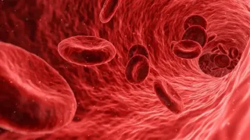 How a national mission can help India tackle sickle cell disease