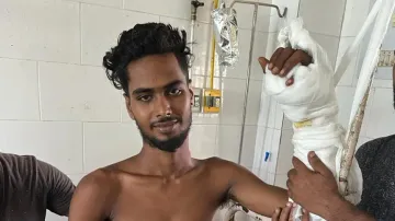 Chopped hand replanted