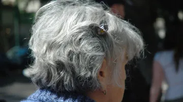 premature greying of hair