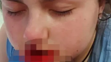 12-year-old girl horrifically mauled by pet dog in Australia
