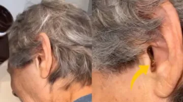 Spider emerges from woman's ear in scary viral video; watch
