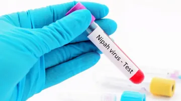 Nipah Virus
