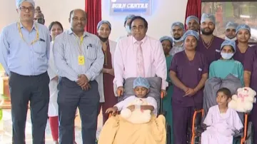 Two critically burnt kids get a new lease of life at Bhubaneswar AIIMS with allograft