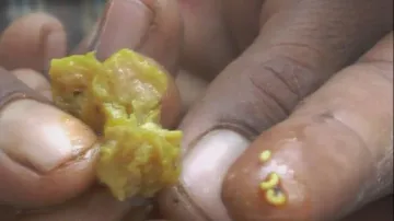 ‘Worm-infested’ MDM curry raises hackles of students, guardians