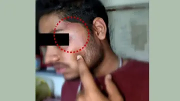 Ragging Alleged At MKCG