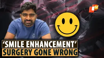 Smile Enhancement, Hyderabad 