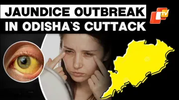 Jaundice Outbreak Triggers Panic In Cuttack; Locals Blame Authorities 