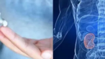 Study shows fairness creams fuelling a surge in kidney problems in India