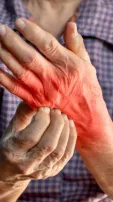 5 Effective Home Remedies To Cure Fungal Infections