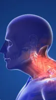 7 Exercises To Reduce Neck Hump And Improve Posture