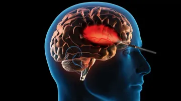 Lucknow hospital surgically treats ‘suicide disease’