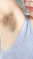 5 Natural Ways To Lighten Dark Underarms