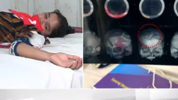 Tantrik pierces multiple needles inside girl’s head in Bolangir, arrested