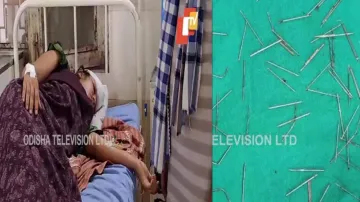 70 needles removed from girl's skull in Bolangir