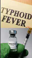 Fever or Typhoid! How To Know  