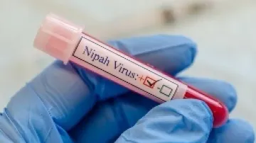 14-year-old Nipah virus patient dies in Kerala, Centre issues advisory