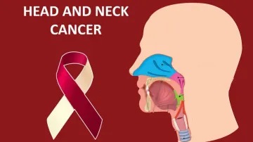 Head and neck cancers on the rise in India, youth at key risk: Experts
