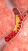 5 Everyday Foods That Can Spike Your Cholesterol Levels