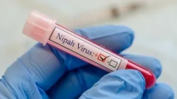 Nipah confirmed in deceased Kerala youth, 151 came into his contact 
