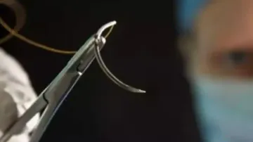 Needle found in girl's arm after tetanus jab at UP hospital; probe ordered