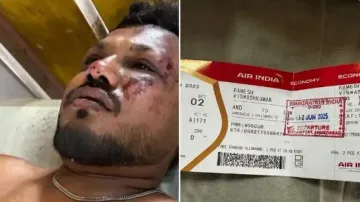 Air India plane crash: Lone survivor Vishwash recalls horrific tale of his miraculous survival; watc