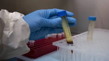 FDA allows emergency use of anti-viral vaccine Remdesivir to treat COVID-19 patients