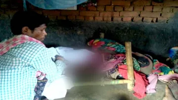 Two brothers stung by bees, die