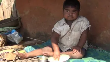 Child struggles with ageing symptoms as poor family seek govt help