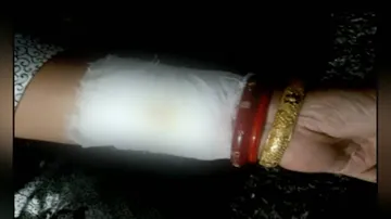 BJD Mahila Morcha vice-president critical after suicide bid