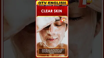 7 Natural Ways to Treat Acne from the Root | OTV