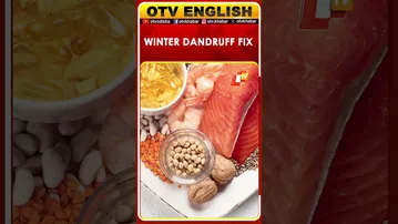 Winter Dandruff Solutions: Quick Tips for a Flake-Free Scalp