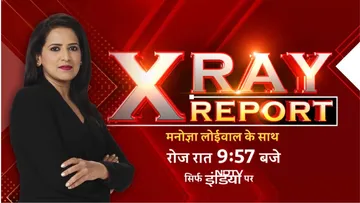 X ray report 