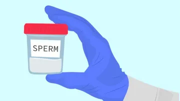 sperm count test