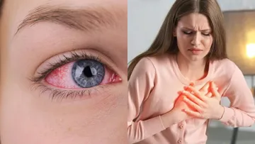 Heart Disease in Eyes