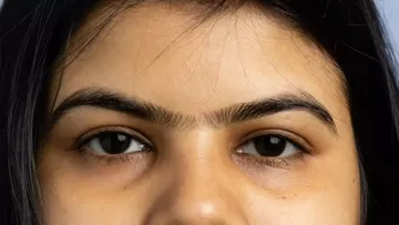 Joined Eyebrows Meaning