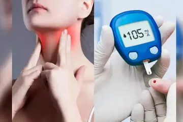 Diabetes and Thyroid