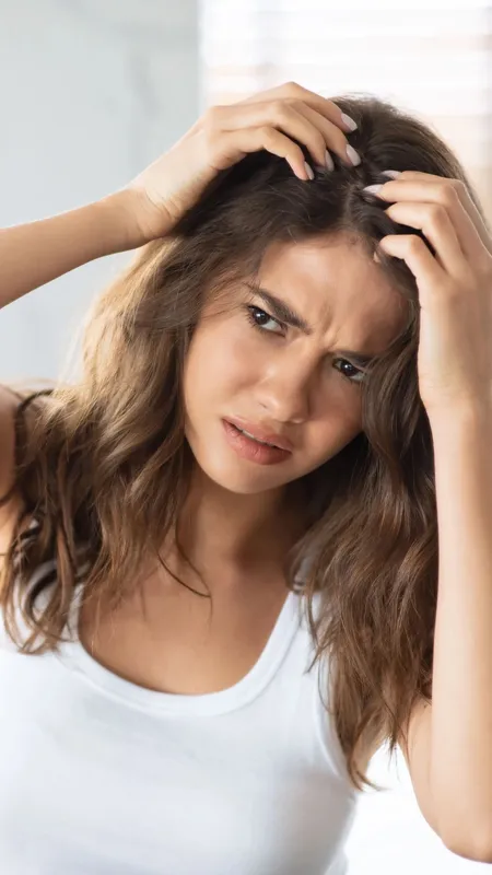 winter dandruff remedies