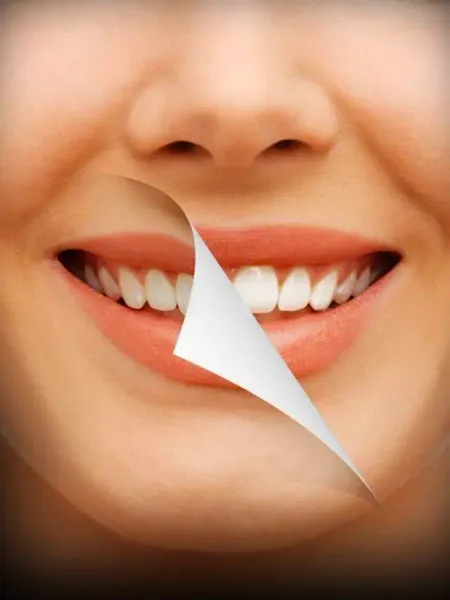 Teeth Whitening Home Remedies